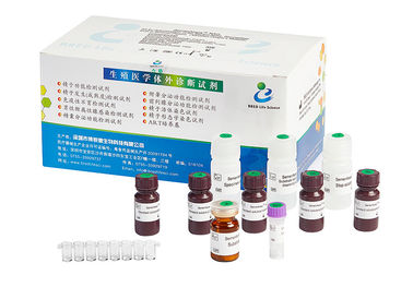 Schneller Test-männliche Ergiebigkeits-Test-Ausrüstung für auswertende männlicher Epididymus-ausscheidende Funktion
